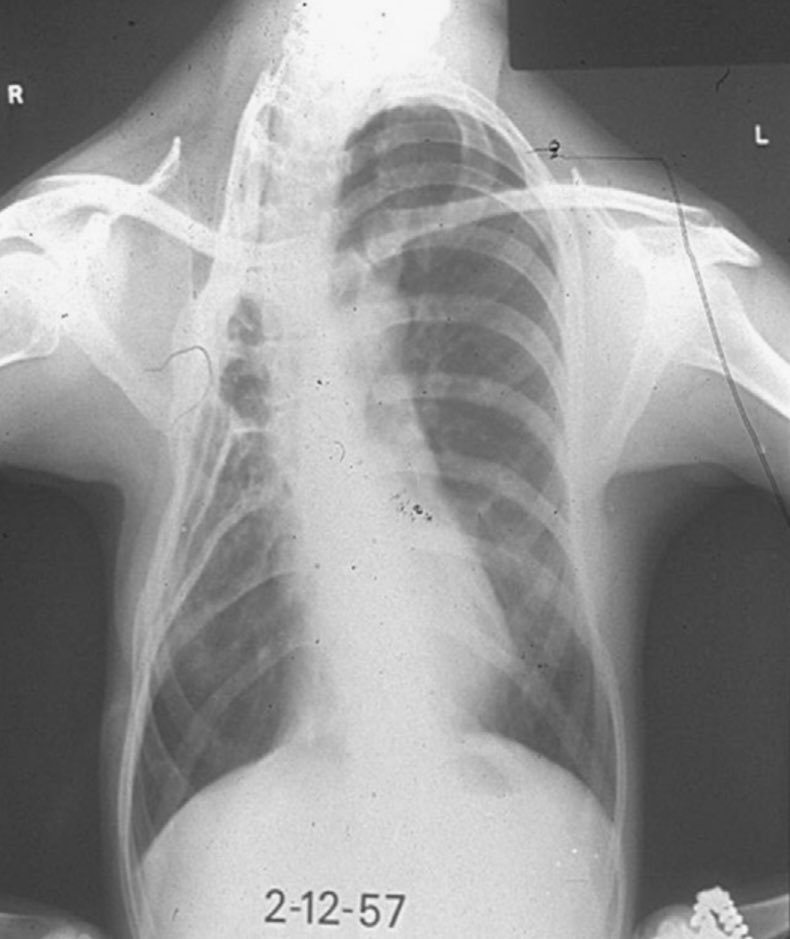 Thoracic Oman tweet media