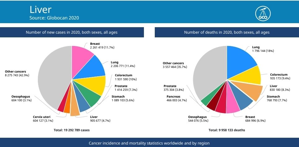Milan🇪🇺🇺🇳🇲🇰 (@mkdmilanm) on Twitter photo #Livercancer is the third most common cause of cancer mortality globally. Just fewer than 900,000 people died of liver cancer in 2020.
#LiverCancerAwarnessMonth <a href="/EU_Health/">EU One Health</a> <a href="/WHO_Europe/">WHO/Europe</a> <a href="/SKyriakidesEU/">Stella Kyriakides</a> <a href="/hans_kluge/">Hans Kluge</a> <a href="/GLOBOCAN_GCO/">Global Cancer Observatory (GCO)</a> <a href="/GICR_IARC/">GICR at IARC</a> <a href="/EASLedu/">EASL Education</a> <a href="/EASLnews/">EASLnews</a> <a href="/EuropeLiver/">European Liver Patients' Association</a> <a href="/ILCAnews/">ILCA</a> #Livercancer is the third most common cause of cancer mortality globally. Just fewer than 900,000 people died of liver cancer in 2020.
#LiverCancerAwarnessMonth <a href="/EU_Health/">EU One Health</a> <a href="/WHO_Europe/">WHO/Europe</a> <a href="/SKyriakidesEU/">Stella Kyriakides</a> <a href="/hans_kluge/">Hans Kluge</a> <a href="/GLOBOCAN_GCO/">Global Cancer Observatory (GCO)</a> <a href="/GICR_IARC/">GICR at IARC</a> <a href="/EASLedu/">EASL Education</a> <a href="/EASLnews/">EASLnews</a> <a href="/EuropeLiver/">European Liver Patients' Association</a> <a href="/ILCAnews/">ILCA</a>