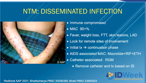 Disseminated Mac