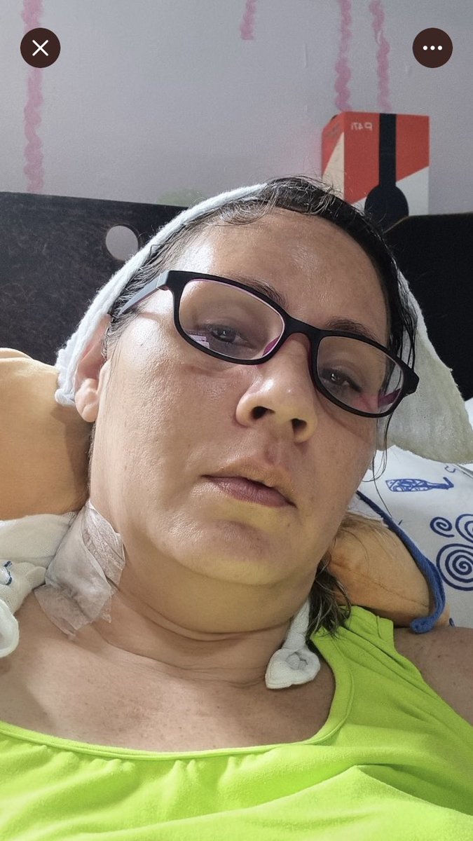 diana_rosenberg's tweet photo. 🆘No nos olvidemos que @NAYCA4 sigue una dura batalla contra el cáncer y necesita de donaciones urgentes para salir adelante.Fue operada de emergencia y está muy delicada👇info para donar 🙏 @roquebarrera74 @ReporteYa @gabyarocha @MiliberMancilla @MelanioBar @GeorgeArtwell @naky https://t.co/pxJdInpLhC