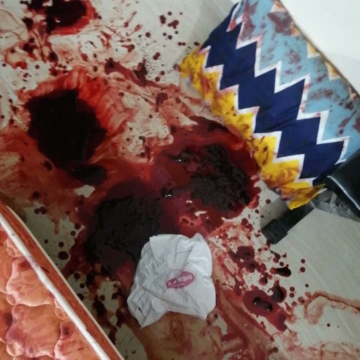deepak_puttala's tweet photo. #🙏😭😭🙏
#Justice for My Sister Sudharani
#Support Sudharani
#Please respond and take serious action and hang Kiran Kumar ASAP.
@narendramodi
@KTRTRS 
@HeroManoj1 
@HMOIndia 
@PawanKalyan 
@RaoKavitha 
@TelanganaDGP 
@SmitaSabharwal 
@trsharish 
@TelanganaCOPs 
@TV9Telugu https://t.co/3sNiEsZuLZ