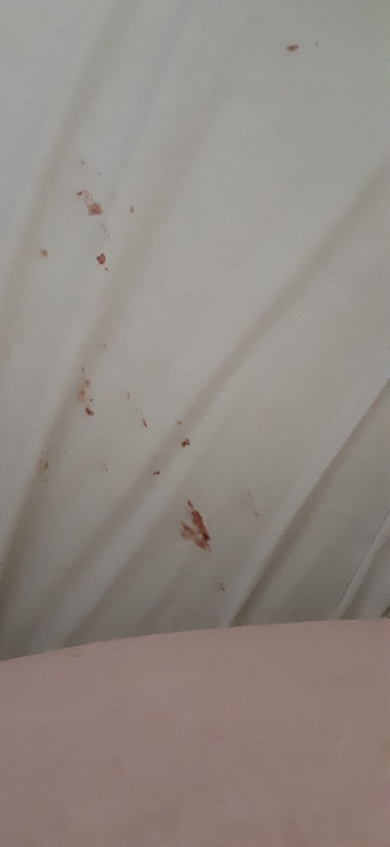 LOVLSLITS's tweet photo. they all opened and bled on my sheets last night 😐😑😐 https://t.co/7sIiPQjdCK