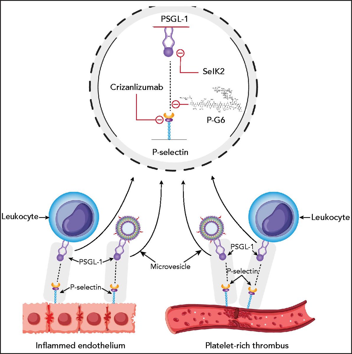 Elliot Chaikof (@echaikof) on Twitter photo Congratulations to all members of our research team <a href="/BIDMCSurgery/">BIDMC Department of Surgery</a> <a href="/harvardmed/">Harvard Medical School</a> for the development of P-G6, a pegylated glycomimetic anticoagulant for the prevention of VTE <a href="/BloodJournal/">ᅟᅟ ᅟ</a>
doi.org/10.1182/blood.…
doi.org/10.1182/blood.…
Glycoscience <a href="/NIH_CommonFund/">NIH Common Fund</a> @nih_nhlbi Congratulations to all members of our research team <a href="/BIDMCSurgery/">BIDMC Department of Surgery</a> <a href="/harvardmed/">Harvard Medical School</a> for the development of P-G6, a pegylated glycomimetic anticoagulant for the prevention of VTE <a href="/BloodJournal/">ᅟᅟ ᅟ</a>
doi.org/10.1182/blood.…
doi.org/10.1182/blood.…
Glycoscience <a href="/NIH_CommonFund/">NIH Common Fund</a> @nih_nhlbi