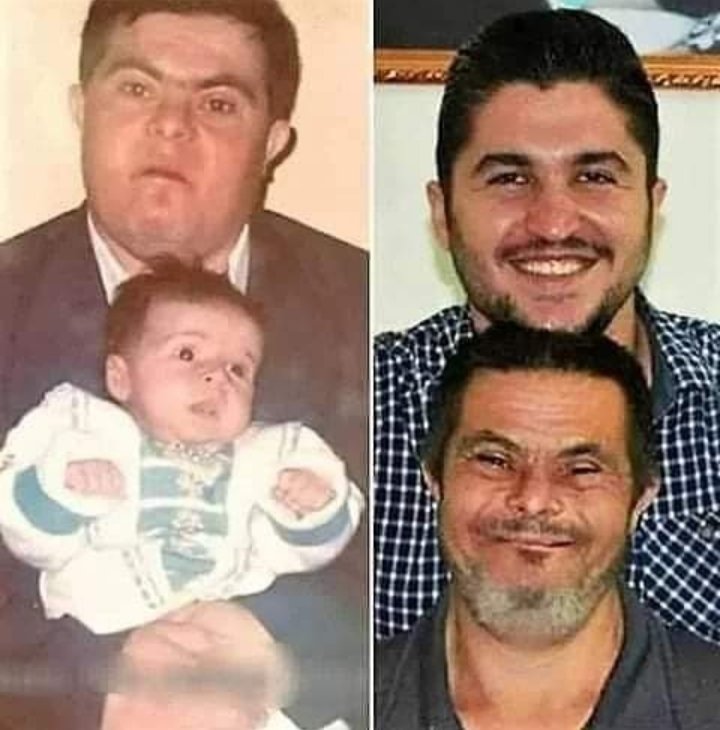 25 yıl fabrikada çalışıp, oğlunu büyütüp, doktor olmasını sağlayan down sendromlu bir baba ve down sendromlu babasıyla gurur duyan doktor olmuş bir evlat...

Kalbimi bıraktım ❤