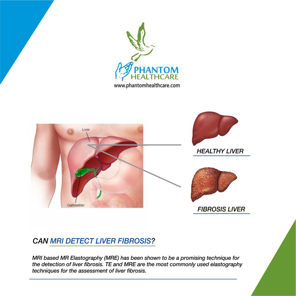 Phantomhealthc's tweet photo. #MRI #CT #MRIScan #CTScan #MedicalImaging #MRIMachines #DiagnosticImaging #Imaging #radiology #radiography #radioimaging #ComputedTomography #MagneticResonanceImaging
#phantomhealthcare #medicaldevices #MRE #Elastography #medicalscan #bodyscan #LiverFibrosis #liver #biotech https://t.co/uR2dy1HDzD