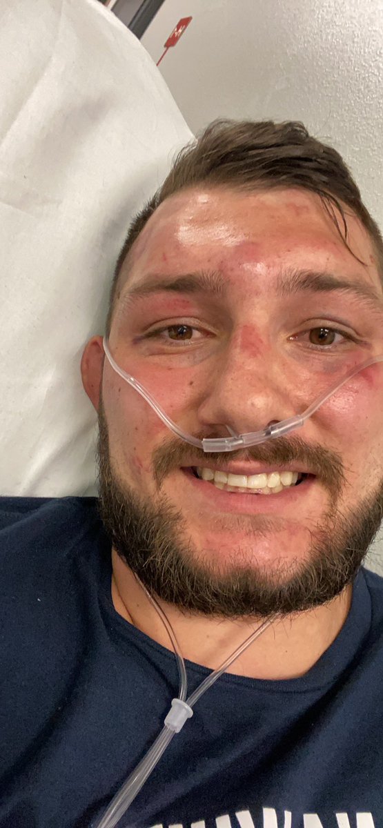 Dylanpottermma's tweet photo. “Failure has made me who I am today. Failure gives you two choices, you stay down or you get up. And right now I’m up, I’m fired up.”

2 weeks post fight, bruising and swelling is just about gone. I’m healing up and working around my injuries. We will be back better, and healthy. https://t.co/qvIuDFj5YU