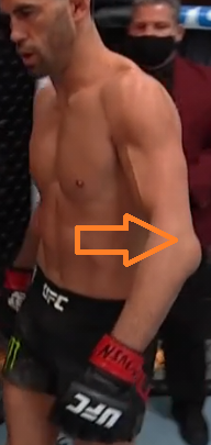 With the announcement of his fight vs Pedro Munhoz @#UFC269, I started looking at Dominick Cruz's recent fights. His left arm still looks odd, after having the broken arm a few years back. The tip of his elbow (the olecranon) is very prominent. This pic is from his last fight. https://t.co/4dYh7znyeP