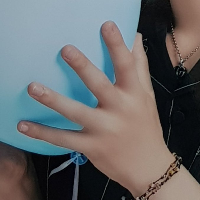 catchxding's tweet image. 사니는 모기물리면 개힘들겟다