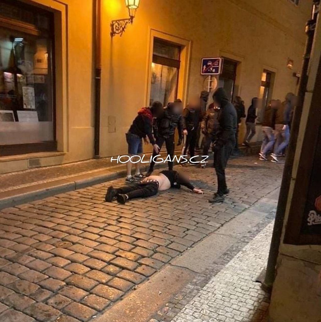 30.09.2021, Sparta Prague🇨🇿 vs Rangers🏴󠁧󠁢󠁳󠁣󠁴󠁿, On the ground, one of Sparta, who was in the front line of the fight and was hit by a glass bottle from Rangers
(Where Sparta was waiting in front of a pub for Rangers, where the Rangers are hidden inside)
#SpartaPrague #RangersFC #UEL