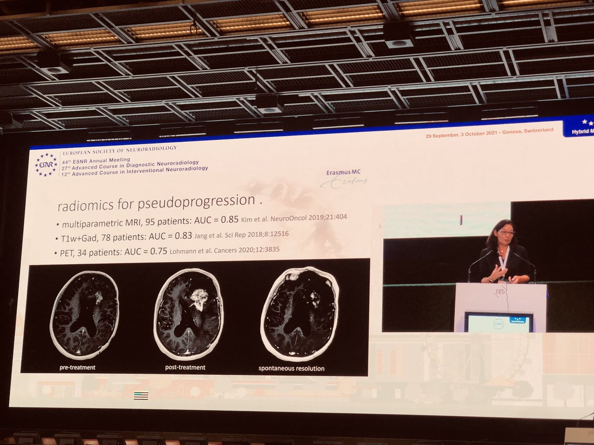 drmankad's tweet image. Prof Marion Smits @MarionSmits makes a compelling case for standardisation of #radiogenomics techniques. Getting the tumor segmentation right would be the first step.