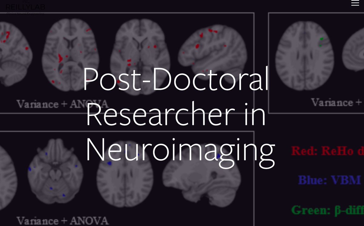 Richard Reilly (@reillyrichardb) on Twitter photo Hiring a new Postdoc in multimodal neuroimaging to join a great team at <a href="/tcddublin/">Trinity College Dublin</a> to study #dystonia by integrating fMRI & structural data with neurocog & clinical measures. Essential: PhD in NeuralEng/Cog discipline + #neuroimaging experience. reillylab.net/openpositions Hiring a new Postdoc in multimodal neuroimaging to join a great team at <a href="/tcddublin/">Trinity College Dublin</a> to study #dystonia by integrating fMRI & structural data with neurocog & clinical measures. Essential: PhD in NeuralEng/Cog discipline + #neuroimaging experience. reillylab.net/openpositions