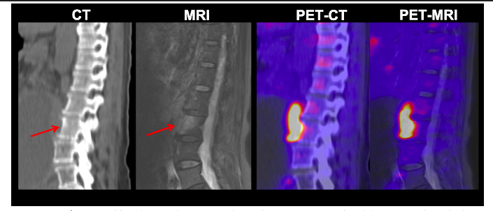 Atul_Monash's tweet photo. Congrats to @tara82931719 on her first first-author publication in Eur J Radiology @ELS_Radiology on the growing #imaging modality - PET/MRI in paediatric disease
Watch this space for more from our group @Mon_Bio_Imaging @NIFAus #MedTwitter
https://t.co/0TjCGQ05yd https://t.co/W8H5V6ty6T