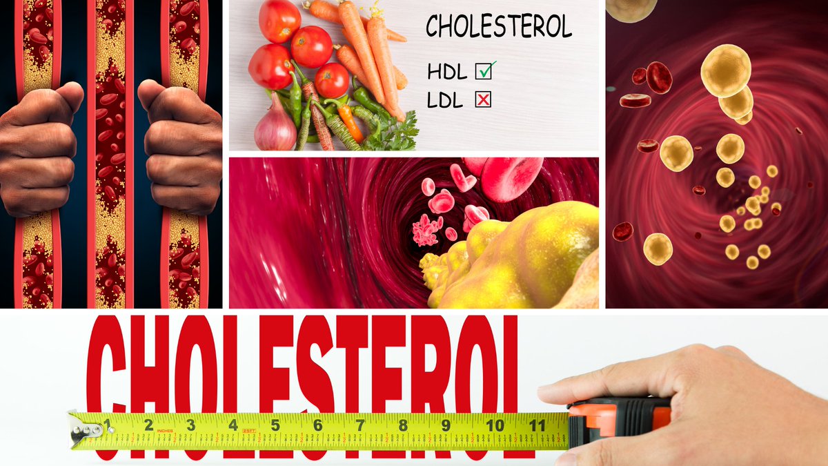 Secondmedic's tweet photo. I just published Why is cholesterol management important? https://t.co/ovEZoxt3O9 https://t.co/RLXh0B31cX
