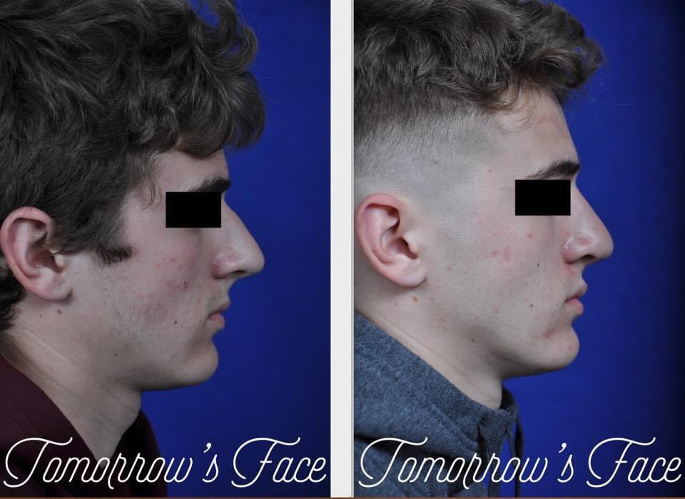 TomorrowsFace's tweet photo. Youβll be #BreathingEasier knowing Dr. Morrow will be performing your #Rhinoplasty. With over 30 years of experience, #DrMorrow is double #BoardCertified in #FacialPlasticSurgery and #Otolaryngology as well as #ENT. Call 973-243-1823 for an appointment today! https://t.co/00yqGJETM6