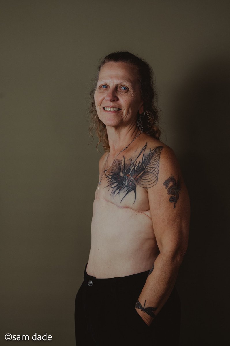 FlatFriends_UK's tweet photo. You are #NotTheOnlyOne

You are not the only woman living without reconstruction. You are not the only one with one breast. You are not the only one with no breasts. 

We are living flat positively.

#livingflat #flatfortnight #mastectomy #breastcancer #previvor #bcam https://t.co/Hy17lmQBvI