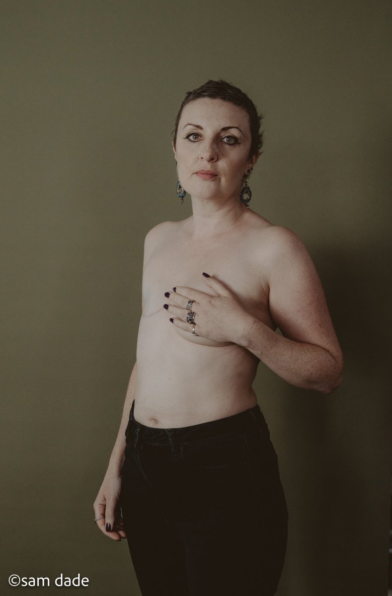 FlatFriends_UK's tweet photo. You are #NotTheOnlyOne

You are not the only woman living without reconstruction. You are not the only one with one breast. You are not the only one with no breasts. 

We are living flat positively.

#livingflat #flatfortnight #mastectomy #breastcancer #previvor #bcam https://t.co/Hy17lmQBvI