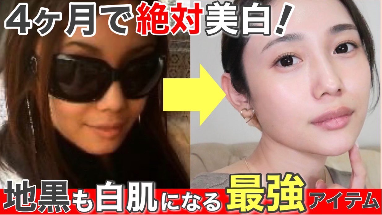 森のニーナ Nina Mori En Twitter 美白 地黒が白肌になった最強アイテムはこれ 美白になる方法 T Co Oioqq0er7u T Co 3uczm0yl0z Twitter