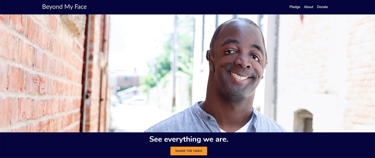 ZvonarPhotos's tweet image. So excited to have been a part of this campaign for @aboutface and to share how beautiful these individual&apos;s truly are. #learn #equality #facialdifferences #proud #portraits #photographer#wallflowermedia