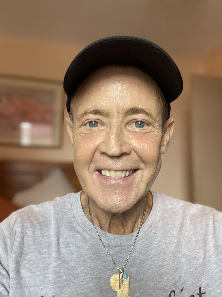 ColumbiaSurgery's tweet photo. Meet Jerry Cahill. Diagnosed with cystic fibrosis (CF) at age 10, he’s been a lifelong fighter &amp; advocate dedicated to empowering others. After a double-lung transplant years ago, @jcahillYCF faced a new challenge this summer: a kidney-liver transplant. ➡️https://t.co/9N897Yif7w https://t.co/Zxc8htN2yo