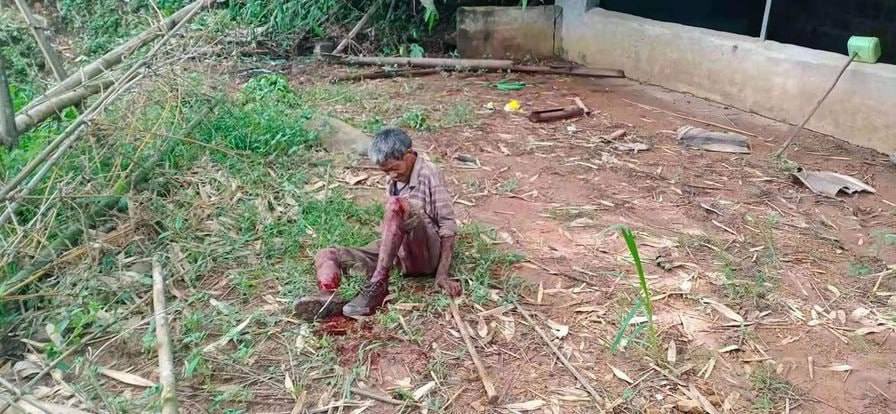 MthinnSpring's tweet photo. Tw// blood, wounds A 64 yrs old man was seriously injured in both legs due to landline by military junta at Phaungsai Village, Mongkong Tsp, Northern Shan State on Sep 30 afternoon. #AcceptNUG_RejectMilitary #WhatsHappeningInMyanmar #Oct1Coup https://t.co/yeJ3UapB8I