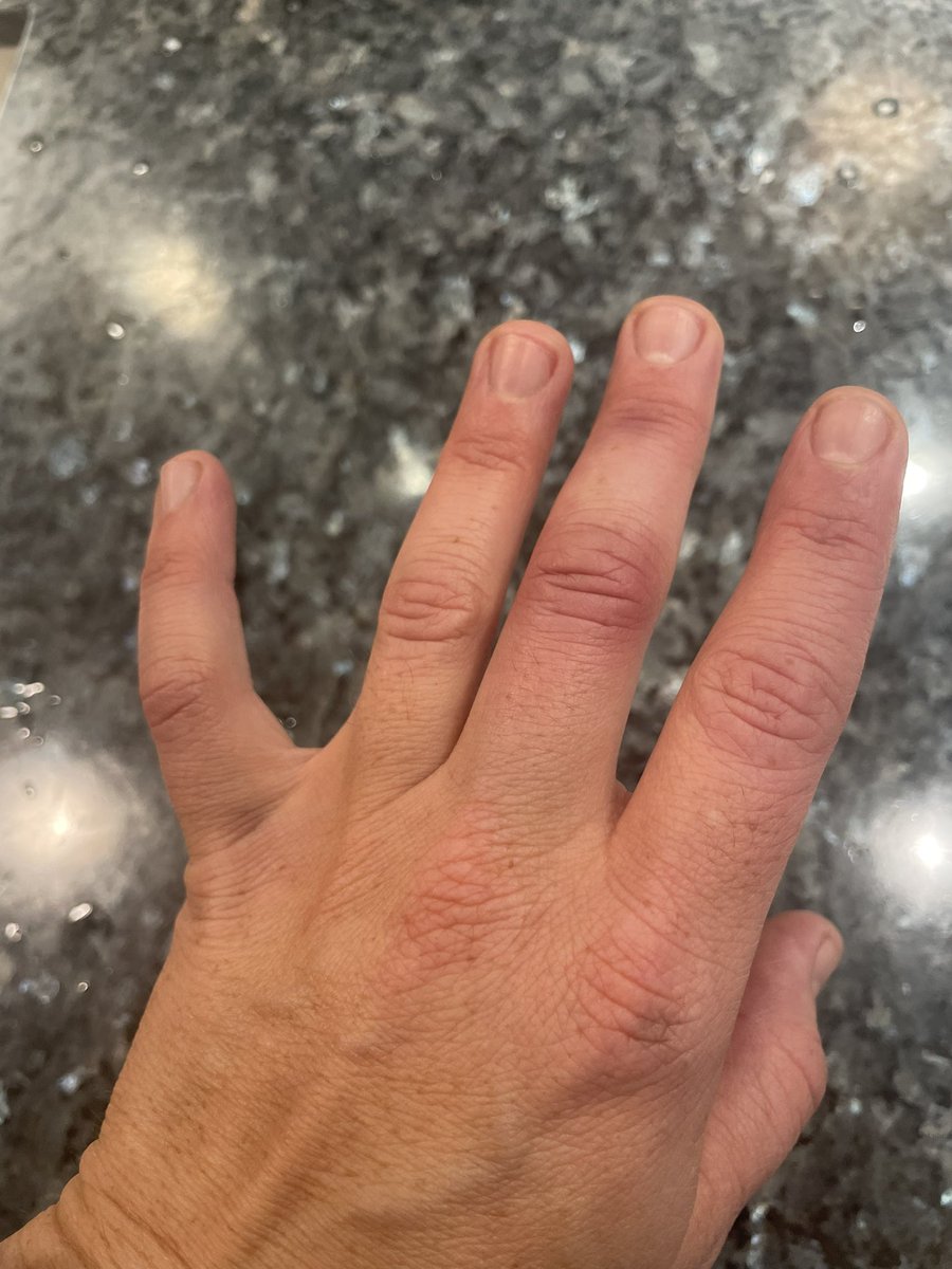 BearSportsMedi1's tweet image. Some of that pre game feels, ouchies in the process, and Friday morning sleepies from Thursday’s @MHSBearFB WIN against Fulshear! Started district with a 💥
#gamevibes
#gamedaysillies
#postgamedaysleepies
@BearSportsMedi1