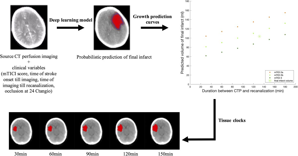 Prediction of #Stroke Infarct Growth Rates by Baseline Perfusion Imaging ow.ly/d9FW50GkhBK