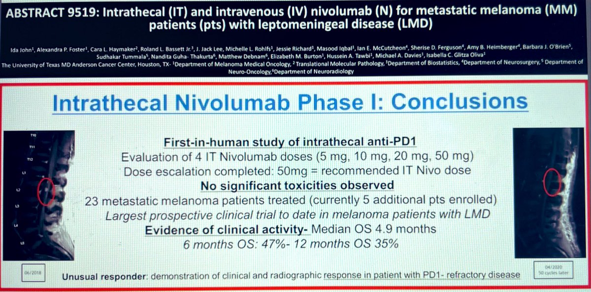 DrKarineTawagi's tweet photo. Insightful updates at today’s 🇨🇦 Immuno-Oncology Summit - including first-line LAG3/PD1 in advanced melanoma, &amp; intrathecal Nivolumab for leptomeningeal disease  #IO2021 #melanoma https://t.co/V4Py7NVYBe