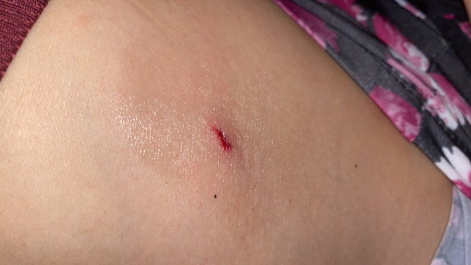 Ouch!!! Ran my hip into my steel gate that was opening. Multitasking is a dangerous game. https://t.