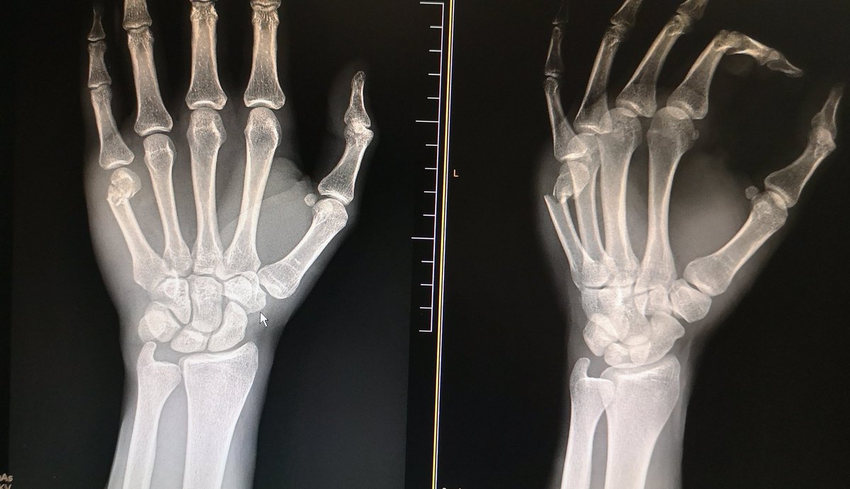 4.20h de la mañana. 

Todavía hay gente que cree tener mas fuerza en su puño que un armario en su puerta.