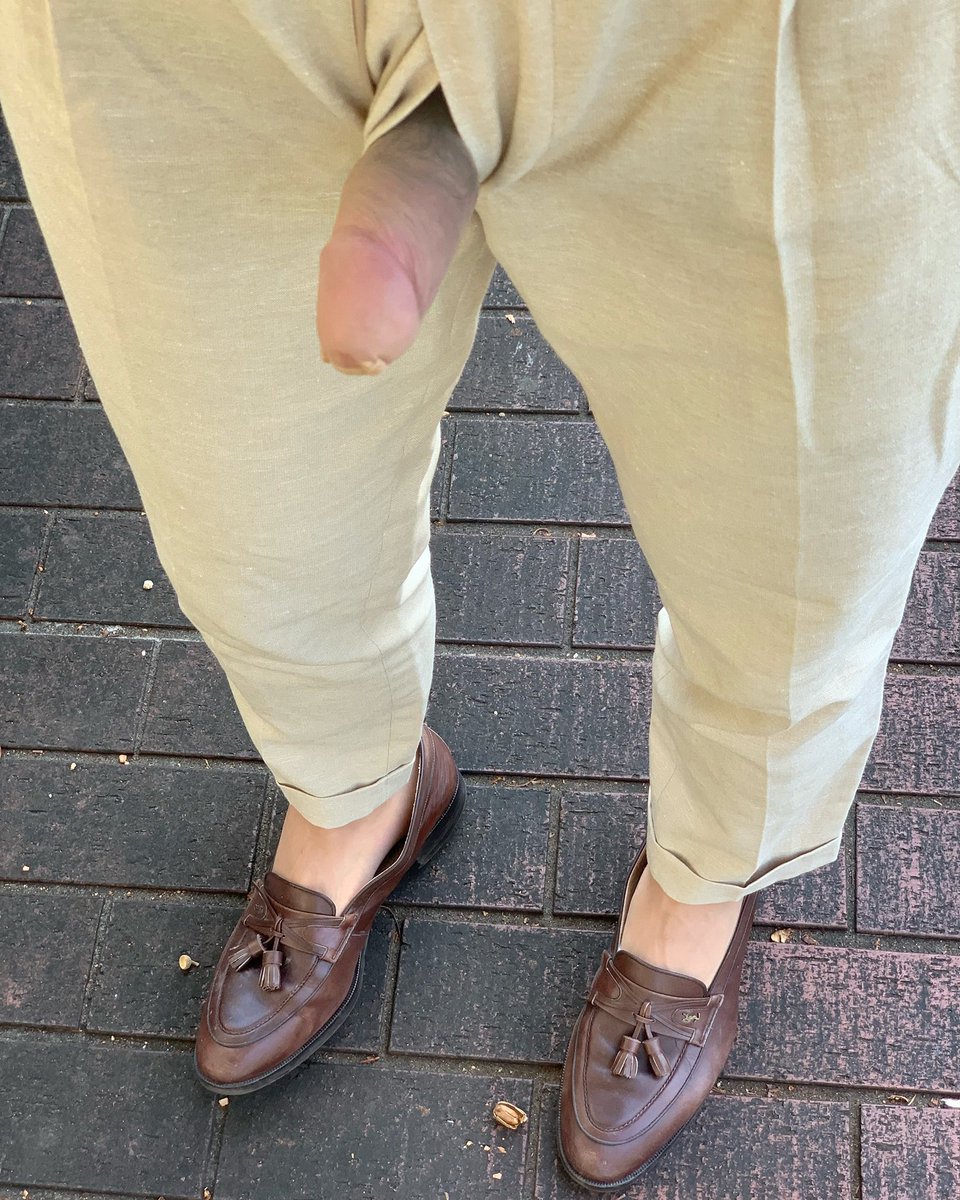 暴露癖