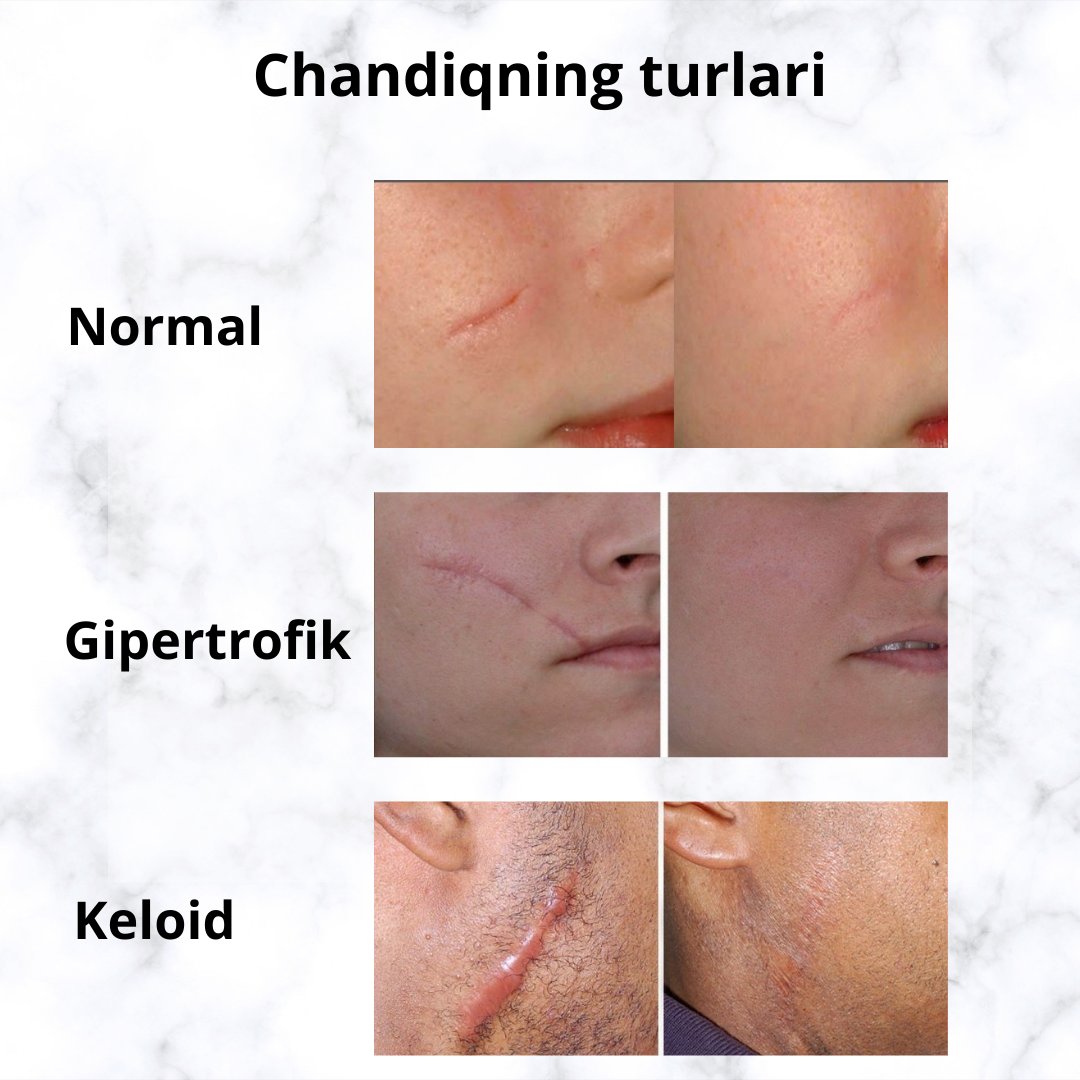 Yalangoch nudist ayollar Kavkaz Dag porno