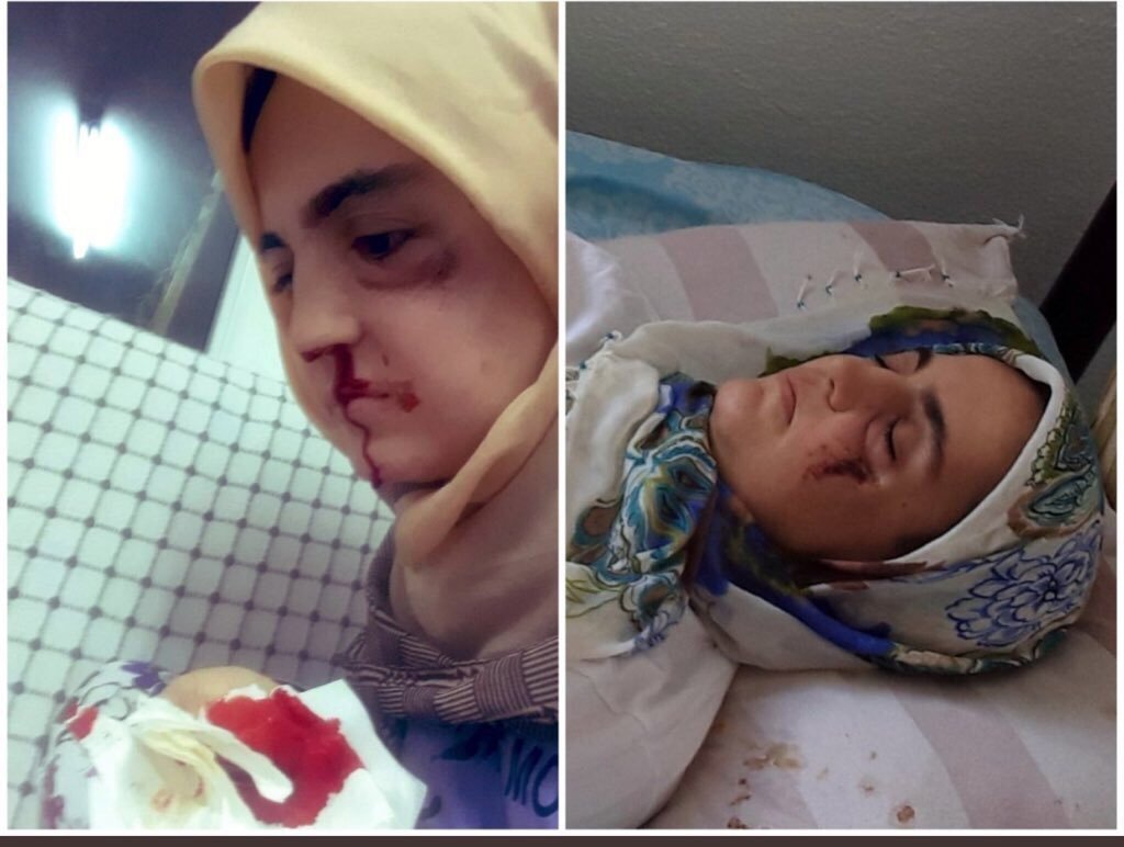 Doktorların birkaç sene yaşar dediği 4.evre kanser hastası Ayşe Özdoğan tutuklanmış. Öldürürken bile zulmediyorlar. Ve siz sessiz kalan, kendi mahallesine adalet bekçisi kendine demokrat tüm yığınlar...Varsa cesaretiniz vicdanınız bu kadına iyi bakın. Sessiz kalanın kabusu olsun!