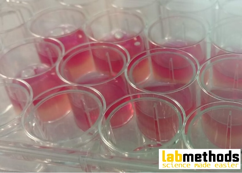 josbaema's tweet image. 📢💙🧫  Cartilage tissue bioprinted models based on blendings of nanocellulose-alginate with embeded chondrocytes🧬🔬

labmethods.org/2021/09/06/car…

🔬🧬A method found in labmethods.org🧬🔬

#Biofabrication #Labmethods #Cartilage #Bioprinting #Nanocellulose  #chondrocytes