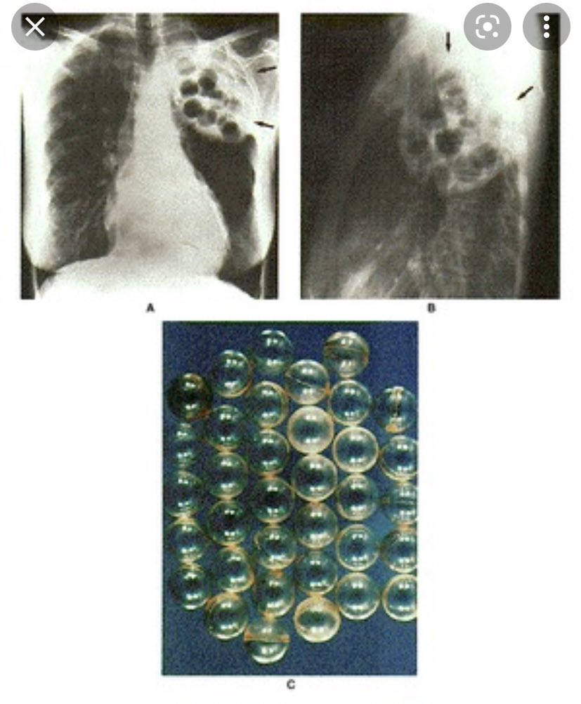 Thoracic Oman tweet media