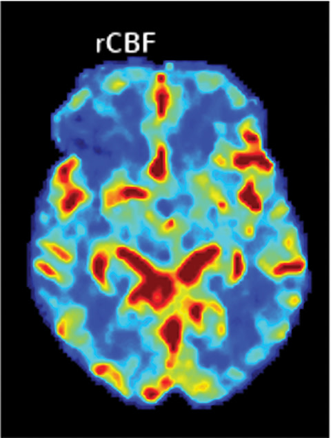 AppliedRadiology (@applied_rad) on Twitter photo Imaging in #Stroke Diagnosis & Treatment | Editor's note: This is the first of a 2-part series. The second part will appear in the Nov-Dec issue Earn 1 Complimentary SA-CME Credit ⏭bit.ly/3ilDZe2 <a href="/AllanLBrookMD/">Allan Brook</a> <a href="/JoshuaAHirsch/">Josh Hirsch</a> <a href="/RichardZampolin/">Richard Zampolin</a> <a href="/MontefioreRAD/">Montefiore Radiology</a> <a href="/MGHImaging/">Mass General Imaging</a> Imaging in #Stroke Diagnosis & Treatment | Editor's note: This is the first of a 2-part series. The second part will appear in the Nov-Dec issue Earn 1 Complimentary SA-CME Credit ⏭bit.ly/3ilDZe2 <a href="/AllanLBrookMD/">Allan Brook</a> <a href="/JoshuaAHirsch/">Josh Hirsch</a> <a href="/RichardZampolin/">Richard Zampolin</a> <a href="/MontefioreRAD/">Montefiore Radiology</a> <a href="/MGHImaging/">Mass General Imaging</a>