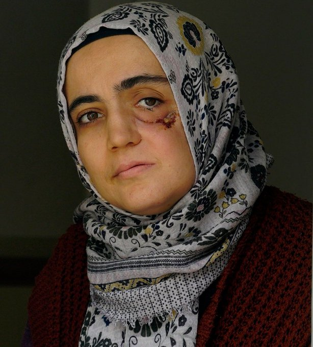 #AyşeÖzdoğan'ı bu halde tutuklamak idam etmektir. Adalet zaten yoktu. Vicdanın da zerresi kalmamış! Yazıklar olsun!