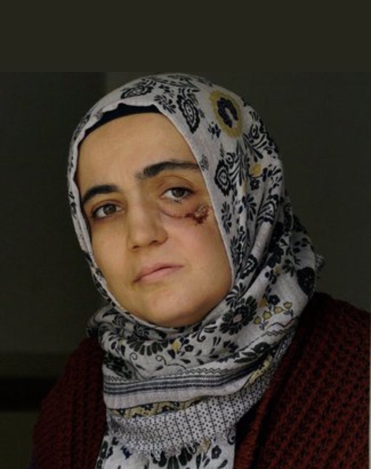 eacarerX's tweet photo. Ayşe Özdoğan: “Can çekişen bir kedi köpek kadar kıymet verilmedi bana…" Anlı şanlı cemaatçilerle ortaklık yapıp, FETÖ Borsasını kurdunuz! Kirlerinizi ölmekte olan bir kadını tutuklayarak mı temizleyecek, toplumu ikna edeceksiniz? https://t.co/Vot8hqT9tm