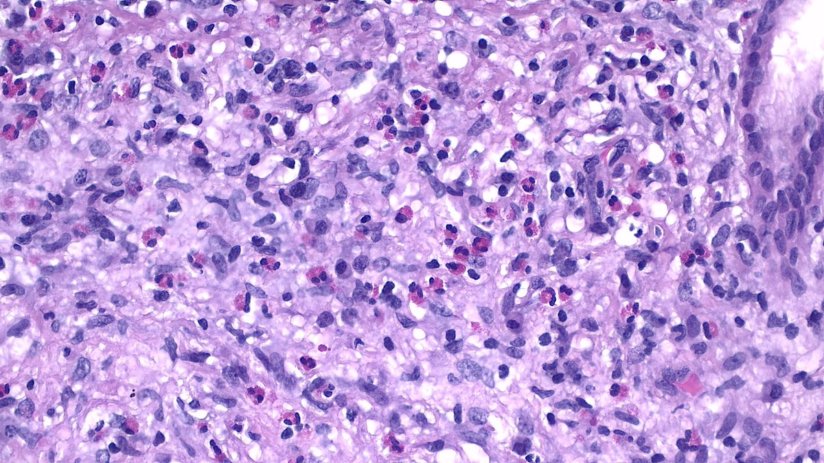 NephroPath's tweet photo. https://t.co/FVB2WkSfPD