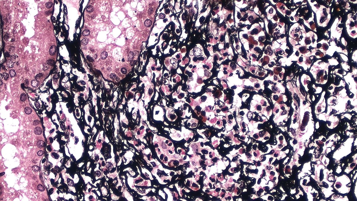 NephroPath's tweet photo. https://t.co/FVB2WkSfPD