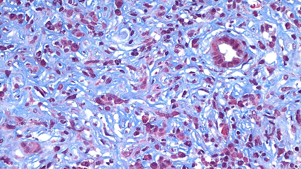 NephroPath's tweet photo. https://t.co/FVB2WkSfPD