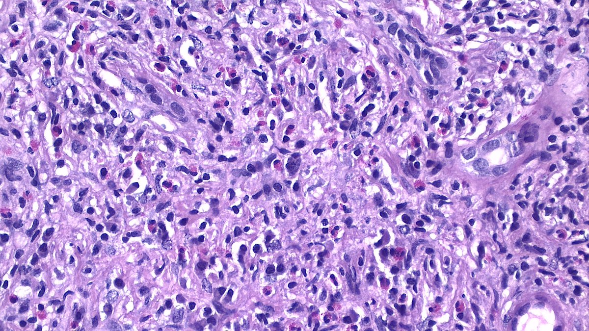NephroPath's tweet photo. https://t.co/FVB2WkSfPD