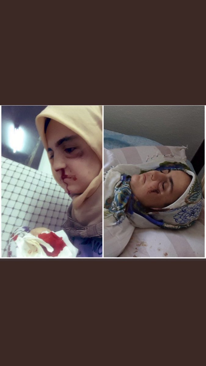 Kanser Hastası Ayşe Özdoğan için tek yürek,tek ses olmalıyız.
 #AyşeÖzdoğanTutuklanmasın