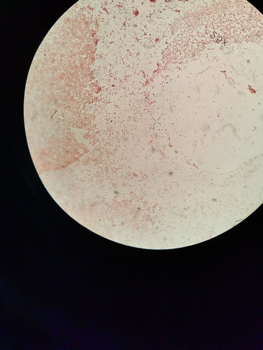 BrivioLab's tweet image. Gram staining 👉🏻 Gram negative
Symbiotic bacteria of nematode

#gram #gramnegative #bacteria #nematodes #symbioticbacteria #gramstaining #microscopy
