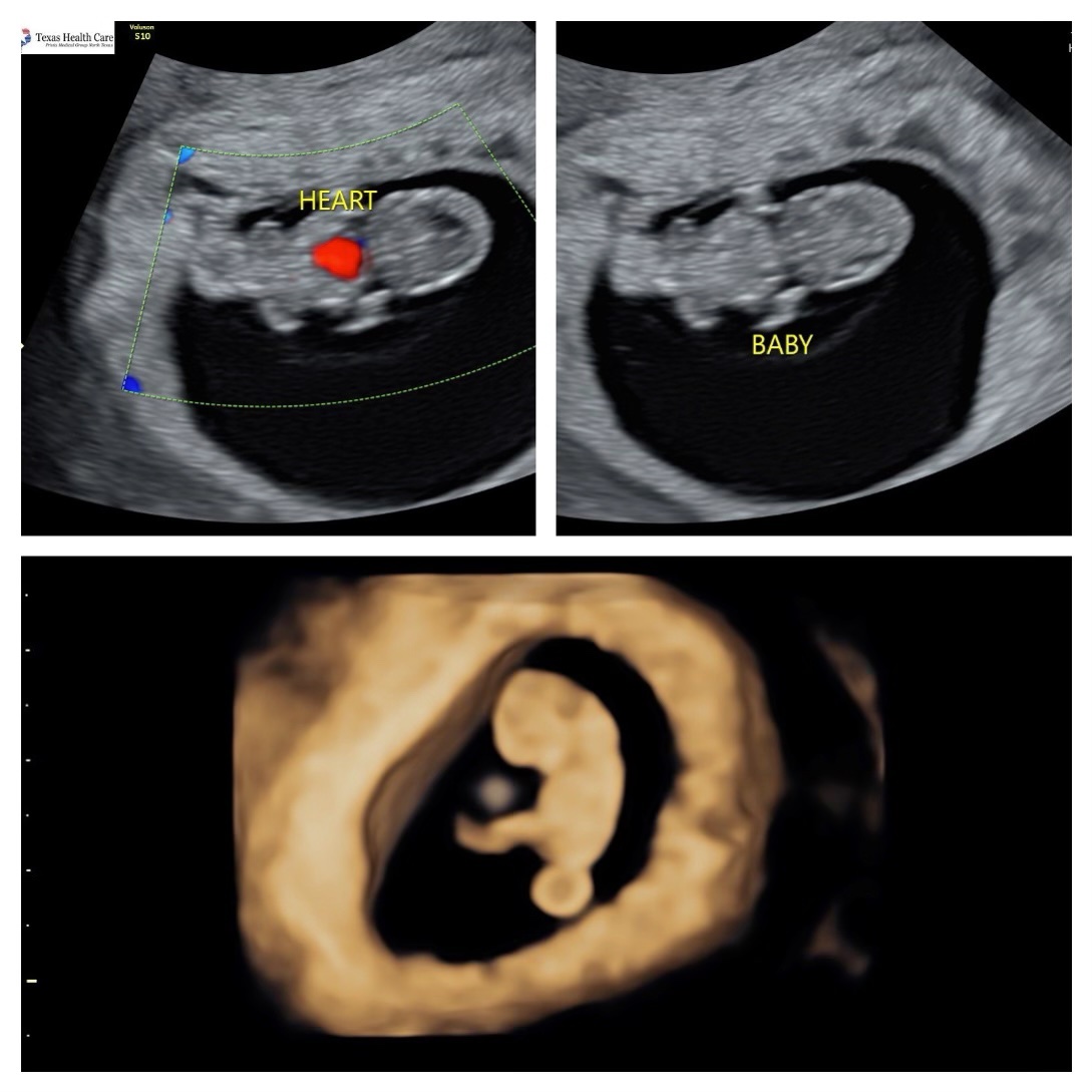 I’m SO excited to be getting a name upgrade! From Mom to Momo. We are beyond thrilled for this sweet baby girl. 💕🎀 
#momolife