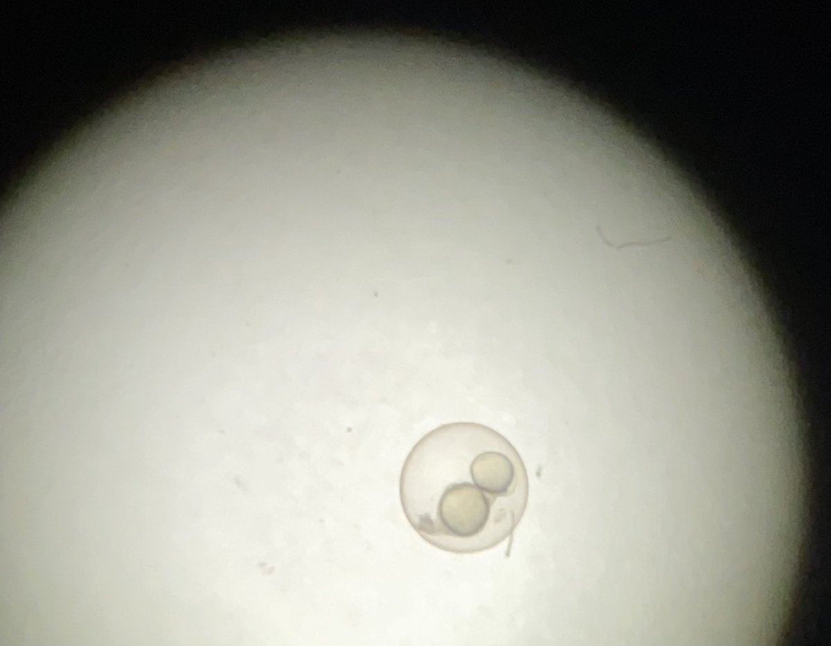 mtn_sky_mtn's tweet photo. 2 zebrafish, 1 chorion! #MLLIA #twinning #nonconjoined #FirstSiting https://t.co/PkN3iafyCq