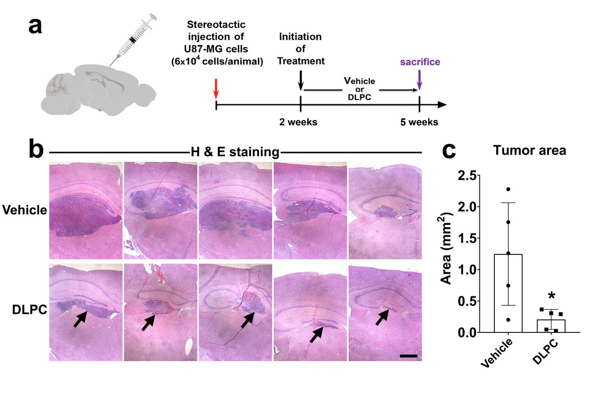 Excited to share our latest work, where we identify NR5A2 as a potential drug target in nervous system tumors including #Glioblastomas and #Neuroblastomas.
@PNASnews <a href="/BRFAA_IIBEAA/">Biomedical Research Foundation Academy of Athens</a> #Glioblastomas #BrainTumors

Link: pnas.org/content/118/39…