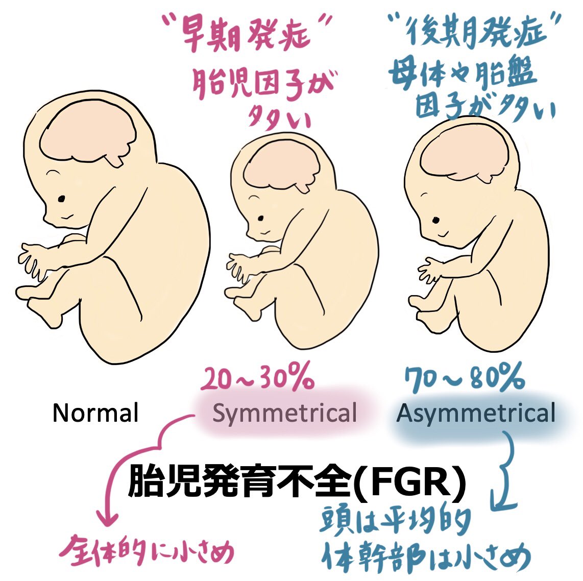 産婦人科医ゆき على X: 産婦人科医ゆき على X: