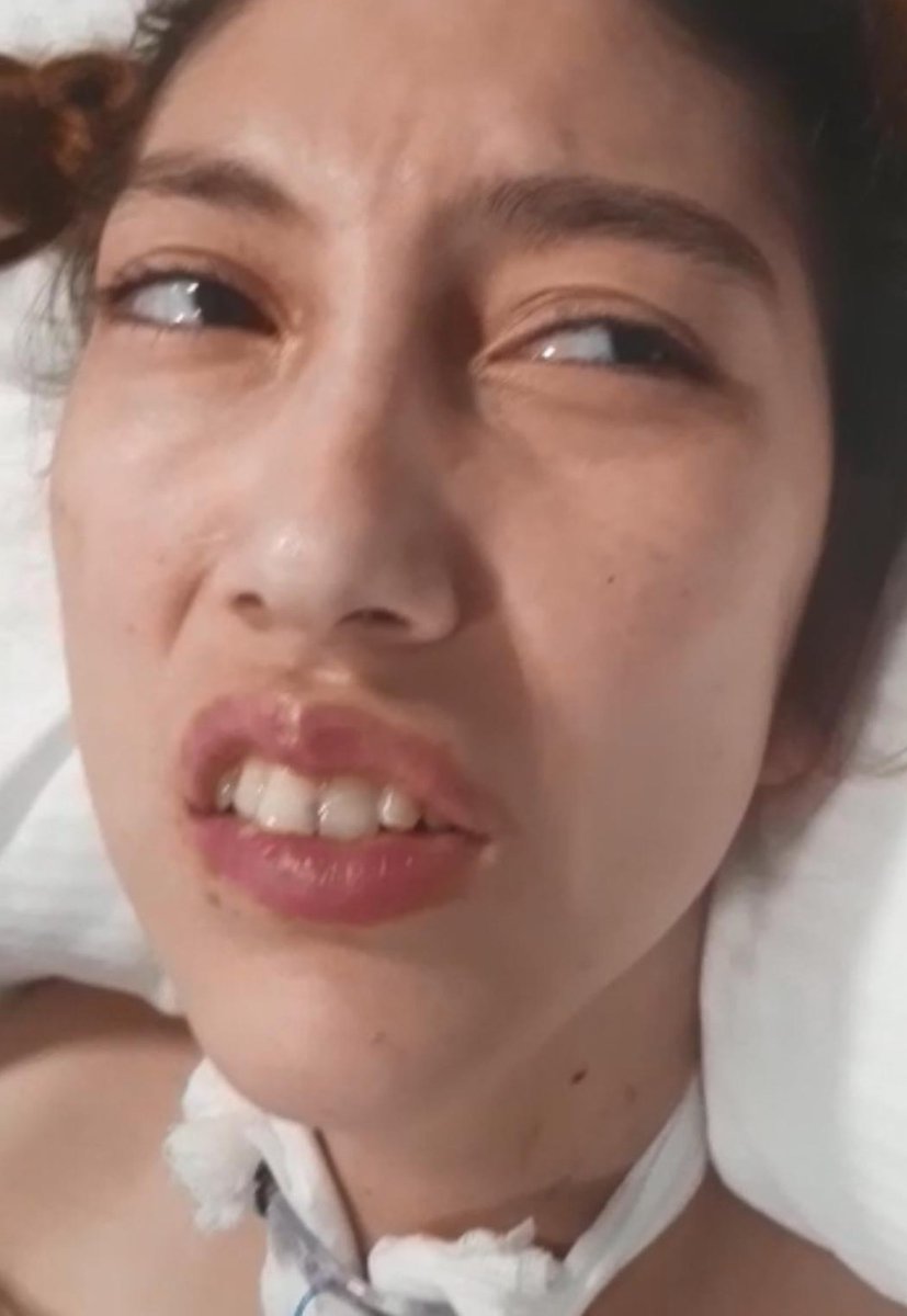 İki ay önce yabancı uyruklu bir cani tarafından saldırıya uğrayan 16 yaşındaki Ayşegül Aydın’ın sesi ol!

Beyin hücrelerinin bir kısmı ölen ve yatağa mahkum olan çocuğumuzun kök hücre tedavisi için bürokratik engeller kalksın, Ayşegül tedavi olsun 

#Ayşegülekökhücre