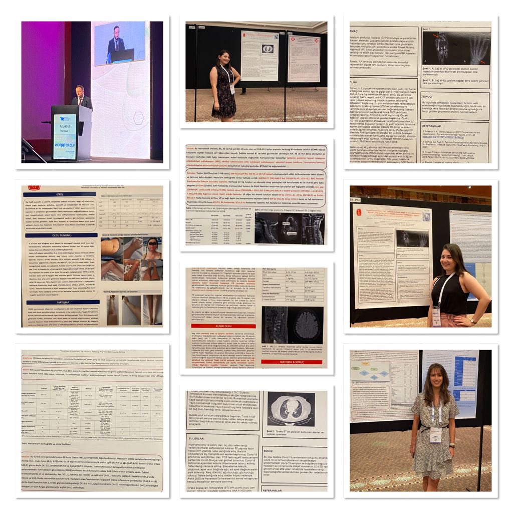 We are extremely happy that 7 abstracts (1 oral presentation) were presented at the National Rheumatology Congress by our amazing internal medicine residents who were eager to do research…We will keep supporting them 👏👏👏<a href="/iertenli/">İhsan Ertenli</a> @romatolojiomer <a href="/lkilic1/">lkilic</a> <a href="/dr_emrebilgin/">Emre Bilgin</a>