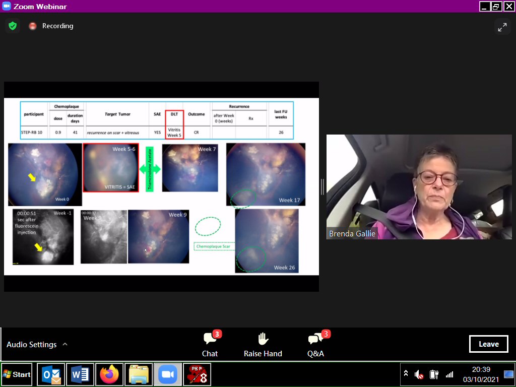wechope's tweet photo. #OneRbWorld2021 Day3: from the road, Prof Brenda Gallie presented #chemoplaque #ClinicalTrial results. Positive outcomes for kids who faced #enucleation after therapy failure. Consideration of #extraocular risk is vital. #Vitritis the only #toxicity so far; monitoring continues. https://t.co/k2kXH00BrE